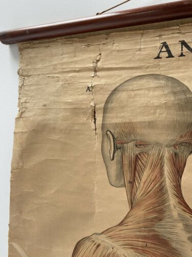 Original Vintage Antique Swedish Anatomical Medical Wall Hanging /1360